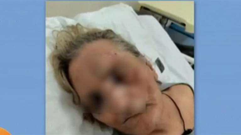 Πρωτοφανές: Ηλικιωμένη έπεσε θύμα ξυλοδαρμού από αποκλειστική νοσοκόμα στο Τζάνειο - Τι καταγγέλλει η κόρη της