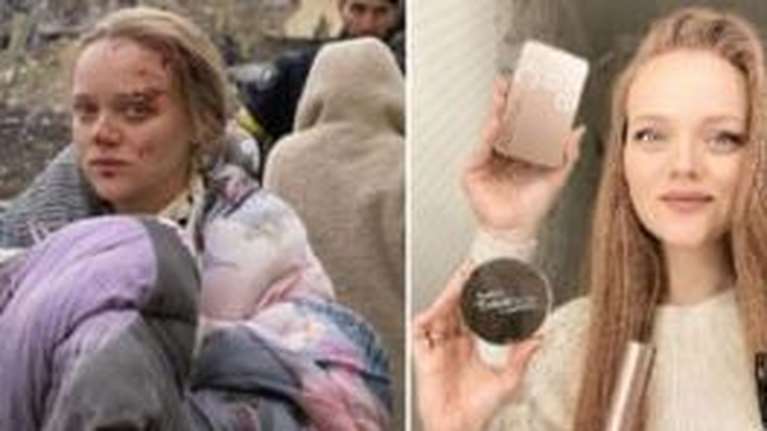 Αδιανόητη ρωσική προπαγάνδα: &quot;Ψεύτικη η τραυματισμένη έγκυος στην Μαριούπολη, είναι blogger και παίζει ρόλο&quot;