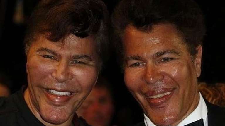 Οι &quot;πλαστικοί&quot; αδελφοί Μπογκντάνοφ: Τα τρομερά παιδιά της γαλλικής σοου μπιζ δεν είναι πια εδώ