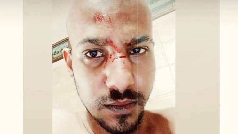 Ομοφοβική επίθεση στη Ναύπακτο - Η οργισμένη ανάρτηση νεαρού που ξυλοκοπήθηκε