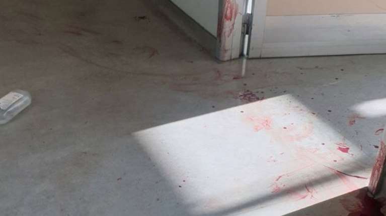 Τραγωδία στο &quot;Αττικόν&quot; - Νέες αποκαλύψεις: Ο 59χρονος που μαχαίρωσε τη νοσηλεύτρια, πίστευε ότι έχει χειρουργηθεί αδίκως