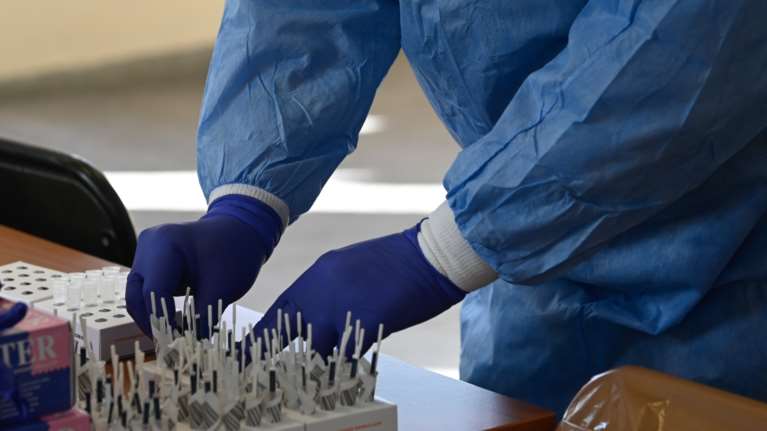 Κορονοϊός: Γιατί μπορεί το PCR να βγαίνει θετικό και το rapid test αρνητικό; Η εξήγηση Μαγιορκίνη
