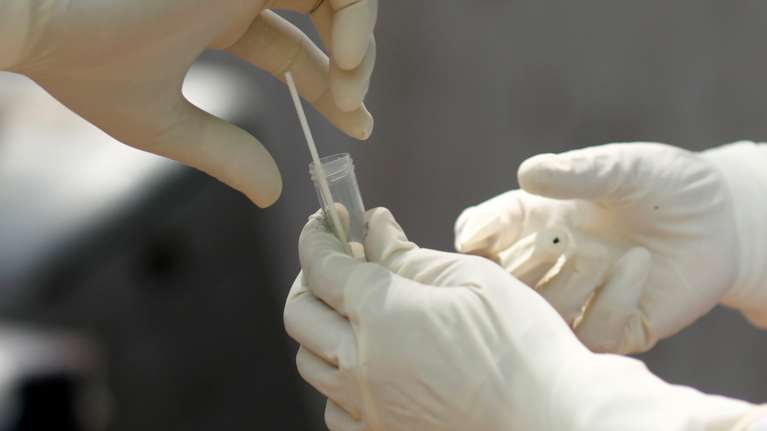 Νέα μελέτη: Ολλανδοί επιστήμονες έφτιαξαν ειδικά αντισώματα στο εργαστήριο κατά του κορονοϊού