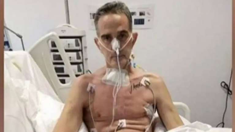 Συγκλονίζει πρωταθλητής μπόντι μπίλντινγκ για τον εφιάλτη με τον κορονοϊό - Εμεινε 2 μήνες στη ΜΕΘ, έχασε 42 κιλά [βίντεο]