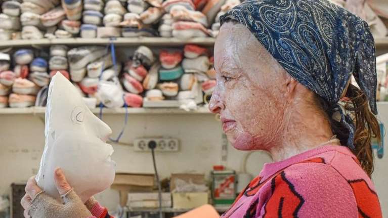 Το twitter υποκλίθηκε στην Ιωάννα Παλιοσπύρου που έδειξε το πρόσωπό της - &quot;Ενα πραγματικό πρότυπο&quot;