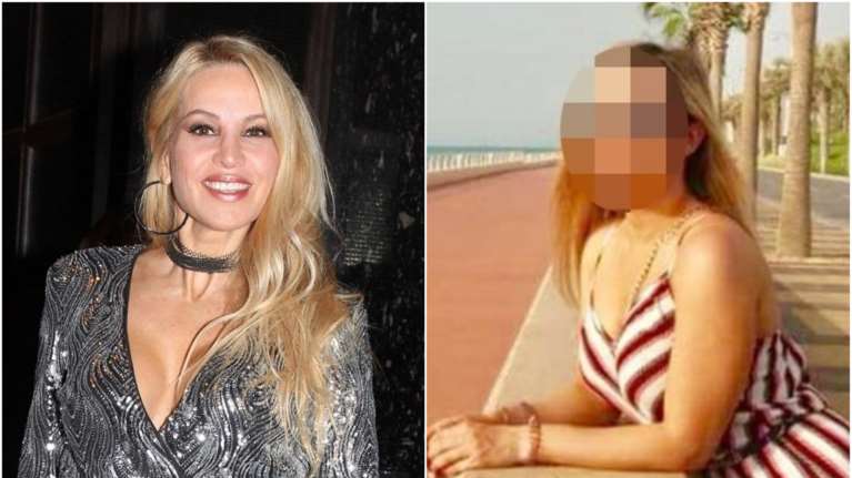 Σοκάρουν οι αποκαλύψεις για την 34χρονη Ιωάννα: Έχουν αφαιρεθεί μεγάλα κομμάτια δέρματος