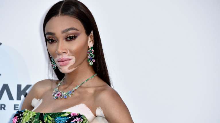 Γουίνι Χάρλοου: Δείχνει το διαφορετικό &quot;κορμί ζέβρας&quot; με μικροσκοπικό μαγιό και αποθεώνεται