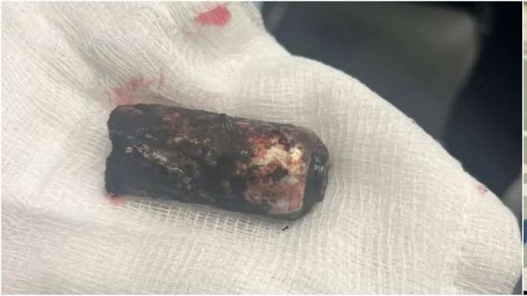 Επεισόδια στου Ρέντη: Αυτή είναι η ναυτική φωτοβολίδα που καρφώθηκε στο πόδι του 31χρονου αστυνομικού