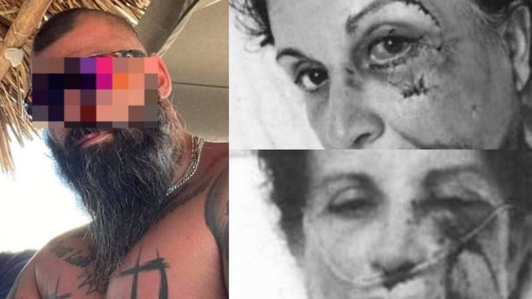 Ξυλοδαρμός στην Αίγινα: &quot;Φουσκωτοί&quot; μπράβοι με τατουάζ... Μίκυ Μάους παραλίγο να σκοτώσουν την ξενοδόχο και τον γιο της