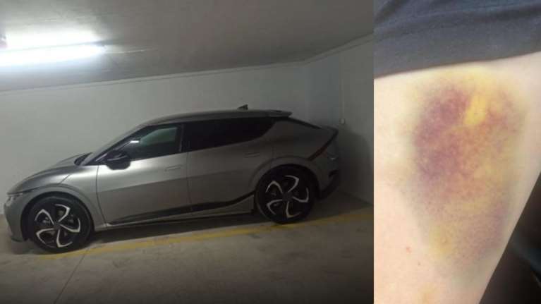 Νέα ντοκουμέντα από τα βασανιστήρια που υπέστη ο γιος επιχειρηματία - θύμα απαγωγής [εικόνες] - Τον τρυπούσαν με κατσαβίδι