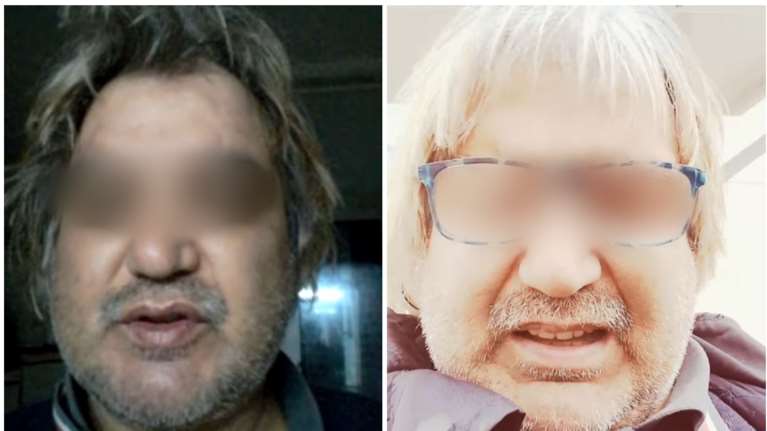 Κορωπί: Ψυχικά υγιής και αμετανόητος ο 51χρονος με το κατσαβίδι- &quot;Θα το ξαναέκανα&quot;