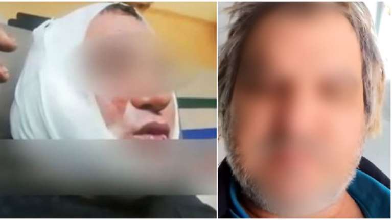 Κορωπί: Σοκάρει το παρελθόν του δράστη με το κατσαβίδι: Του είχαν κόψει το αυτί σε καβγά σε λαϊκή αγορά