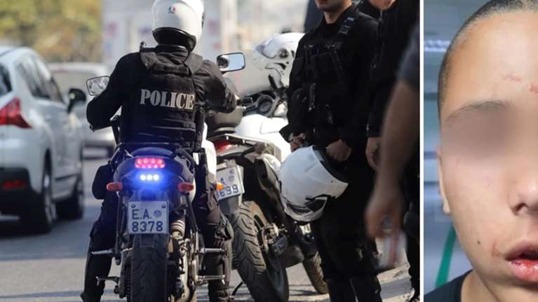 Μεταμόρφωση: Δέκα ανήλικοι επιτέθηκαν με σιδερογροθιές σε 17χρονο - Συνελήφθη 13χρονος