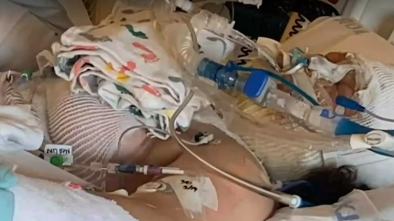 Η επικίνδυνη &quot;μόδα&quot; του Tik Tok: Με εγκαύματα 13χρονη από το παιχνίδι του &quot;αναμμένου καθρέφτη&quot; [βίντεο]