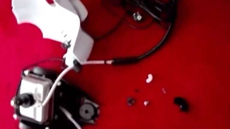 Παραλίγο τραγωδία για 44χρονη μητέρα - Εξερράγη η ηλεκτρική σκούπα και της έκαψε το πόδι [Βίντεο]