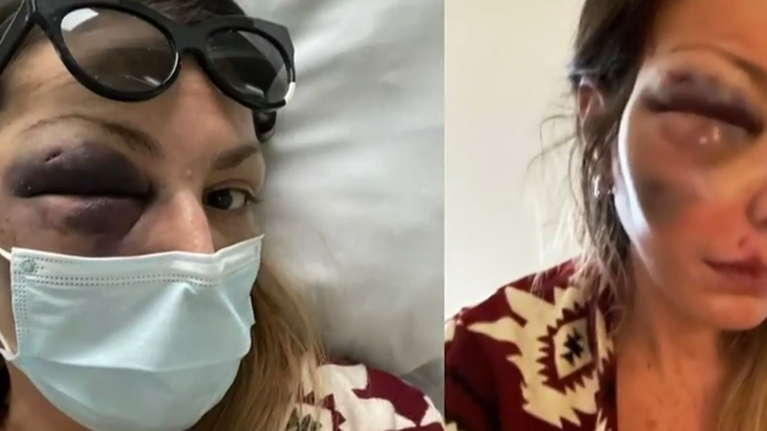 Στεφανία Τζαφέρη: "Δέχτηκα απειλές ότι θα μου κλείσουν και το άλλο μάτι" - Σε κατάσταση σοκ η food blogger