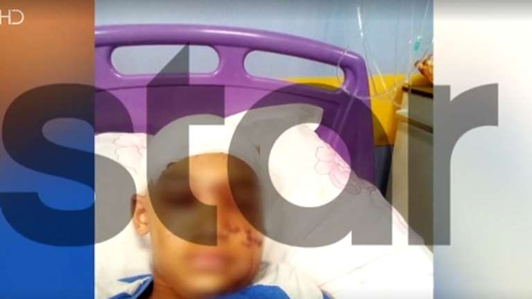 Λούτσα: Χειρουργήθηκε ο 11χρονος που τον δάγκωσε πιτ μπουλ - &quot;Έβαλε τέσσερις φορές το χέρι του στο στόμα του σκύλου&quot;