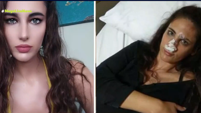 Ναστάζια Μητροπούλου: &quot;Έσπασε η σπονδυλική μου στήλη από τις κλωτσιές&quot; - Τα χειρουργεία μετά την κακοποίηση