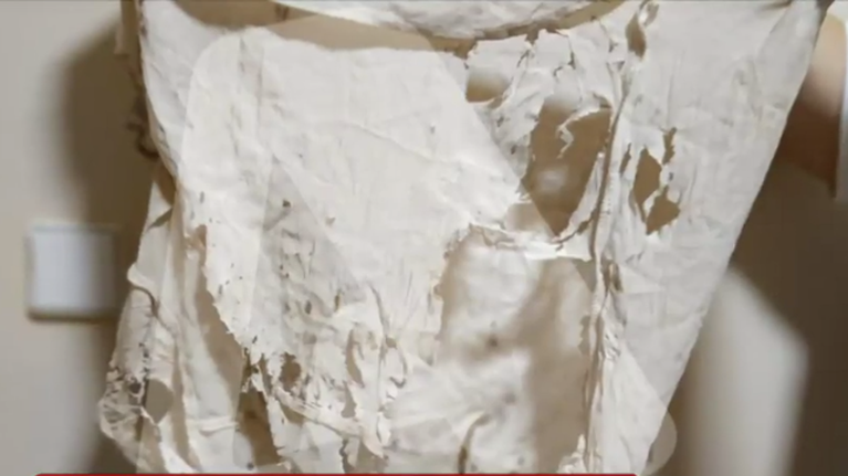 Βιτριόλι: Εικόνες σοκ με τα λιωμένα ρούχα της Ιωάννας μετά την επίθεση [βίντεο]