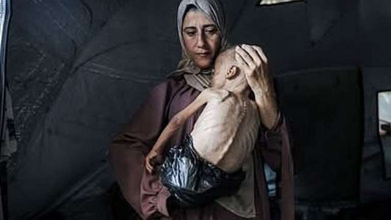 Γάζα: Ωρα μηδέν για χιλιάδες παιδιά - Η ιστορία της συγκλονιστικής φωτογραφίας με ένα από τα σκελετωμένα μωρά