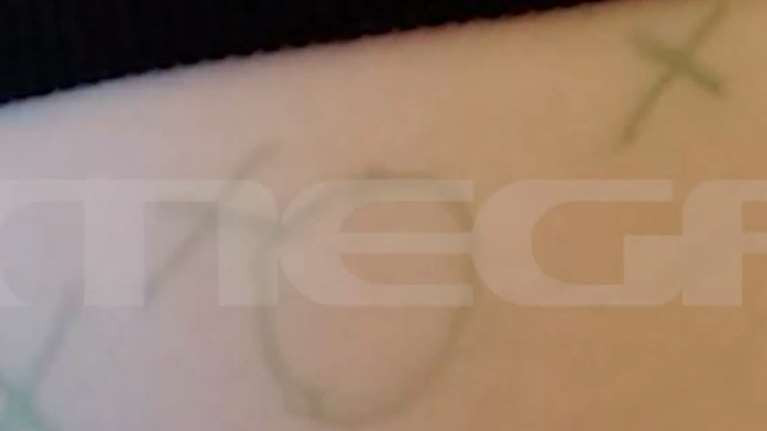 Βόλος: Η τρίλιζα που ζωγράφισαν στο σώμα του 7χρονου - &quot;Ένιωσα να με σνομπάρουν στο σχολείο&quot; είπε ο πατέρας του