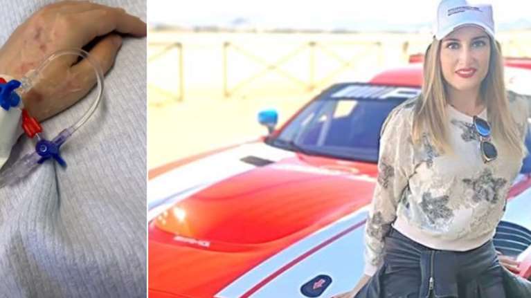 Επίθεση με βιτριόλι: Η συγκλονιστική φωτογραφία που ανέβασε η Ιωάννα από το νοσοκομείο - Δείχνει τα εγκαύματά της