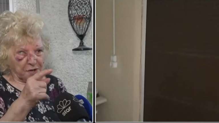 Βύρωνας: Σοκάρει η ηλικιωμένη που κακοποιήθηκε βάναυσα από ληστή - &quot;Τον παρακάλεσα να σταματήσει να με χτυπάει&quot; [βίντεο]