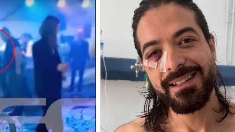 Μουγκοπέτρος: Βίντεο μετά τον τραυματισμό του - &quot;Τον σκότωσα, τον σκότωσα&quot; φώναζε ο φίλος του που έδωσε την κροτίδα