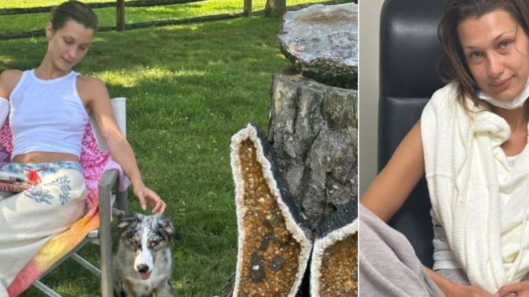 Καταβεβλημένη η Μπέλα Χαντίντ, μοιράστηκε φωτογραφίες από τις θεραπείες της - Η μάχη που δίνει με τη νόσο Lyme