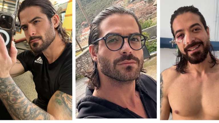 Άρης Μουγκοπέτρος: Θα πάει στο Α.Τ. ο φίλος που του έδωσε την κροτίδα - Μάχη για να σωθεί το τρίτο δάχτυλο του μουσικού