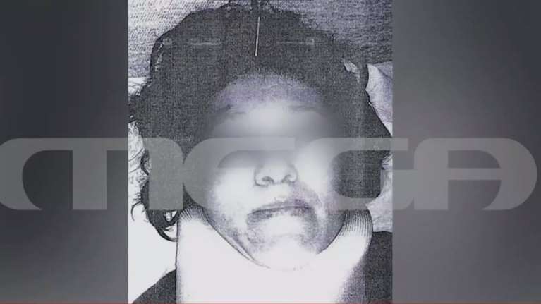 &quot;Φοβάμαι ότι θα με αποτελειώσει&quot;: Συγκλονίζει η 38χρονη που δέχτηκε επίθεση με βαριοπούλα από τον σύζυγό της [Βίντεο]