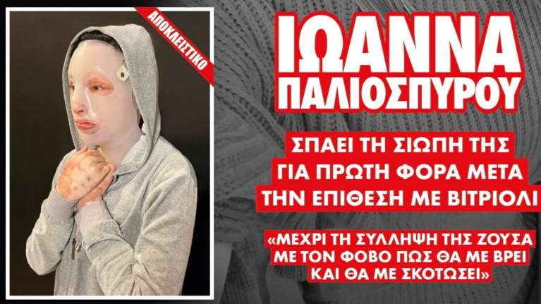 Επίθεση με βιτριόλι: Συγκλονίζει η γιατρός της Ιωάννας - Με ειδική μάσκα και ειδικό ένδυμα σε όλο της το σώμα [Βίντεο]