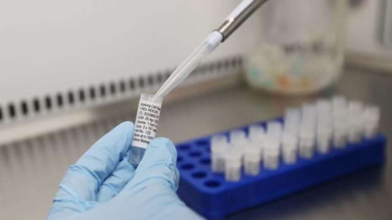 AstraZeneca: Από το επόμενο καλοκαίρι η φαρμακευτική εταιρεία θα έχει κέρδη