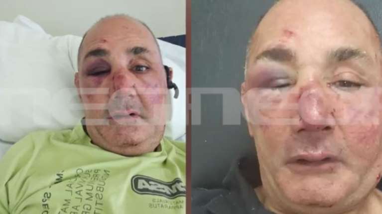 Ρόδος: Σοκάρει η άγρια επίθεση και ληστεία σε κοσμηματοπώλη - "Έλεγα ότι θα πεθάνω" [βίντεο]