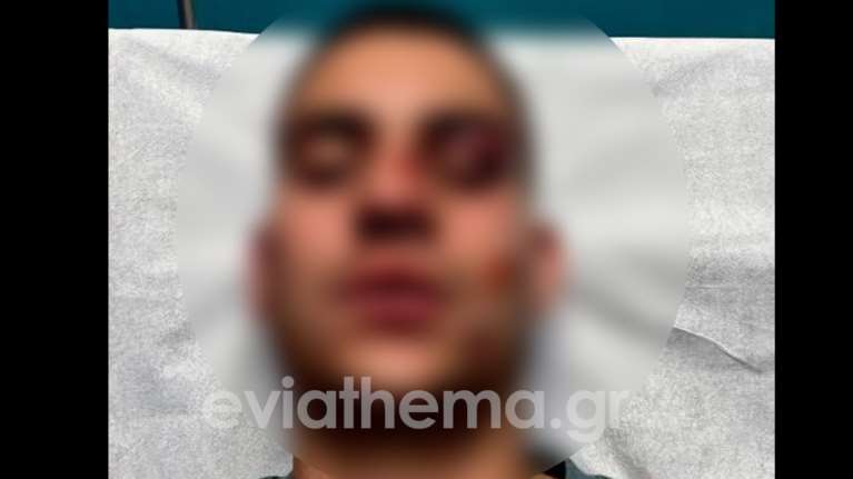 Απίστευτο: Εστειλε 19χρονο στο νοσοκομείο Χαλκίδας με κατάγματα επειδή έκανε ένα "like" στην κοπέλα του