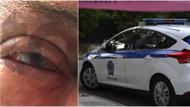 Γλυφάδα: Συνελήφθη ο Ισραηλινός για τον ξυλοδαρμό του επιχειρηματία στο εστιατόριο - Αρνείται ότι του χρωστάει λεφτά