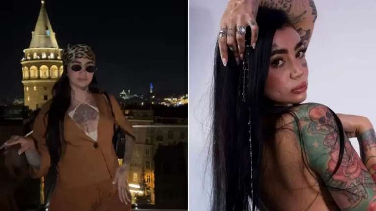 Τουρκία: Νεκρή Βραζιλιάνα influencer μετά από επέμβαση λιποαναρρόφησης στην Κωνσταντινούπολη