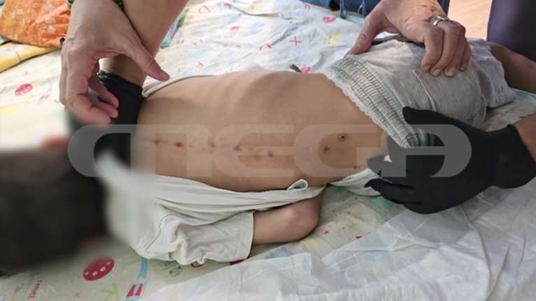 Θρίλερ στην Πάτρα με τον 10χρονο στον Καραμανδάνειο - Επιμένει στην κακοποίηση ο γιατρός που τον εξέτασε