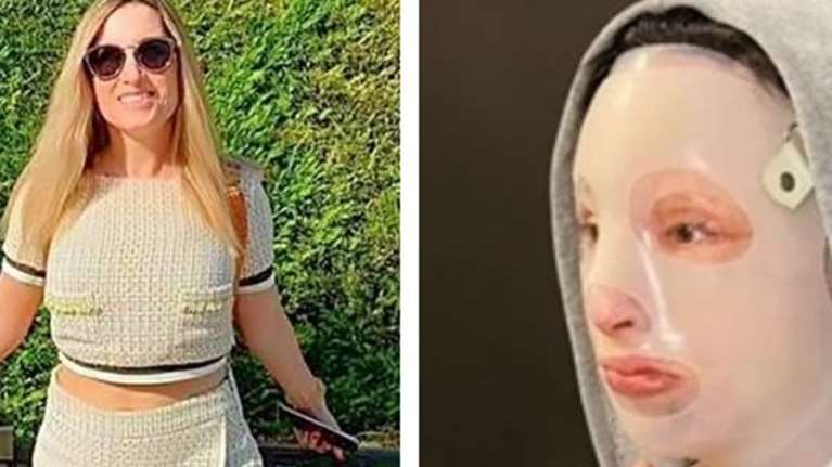 Επίθεση με βιτριόλι: Η συγκλονιστική εξομολόγηση της Ιωάννας - Τι ζητά ένα χρόνο μετά