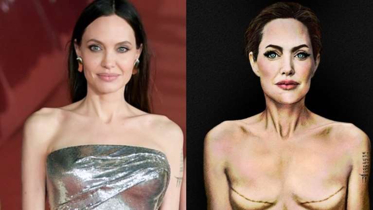 Η Αντζελίνα Τζολί έγινε γκράφιτι στην Ιταλία: Με ουλές μαστεκτομής στέλνει μήνυμα για την πρόληψη του καρκίνου