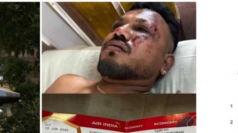 &quot;Θαύμα που ζω, αλλά υποφέρω&quot;: Συγκλονίζει ο μοναδικός επιζών της αεροπορικής τραγωδίας στην Ινδία με τους 241 νεκρούς [βίντεο]