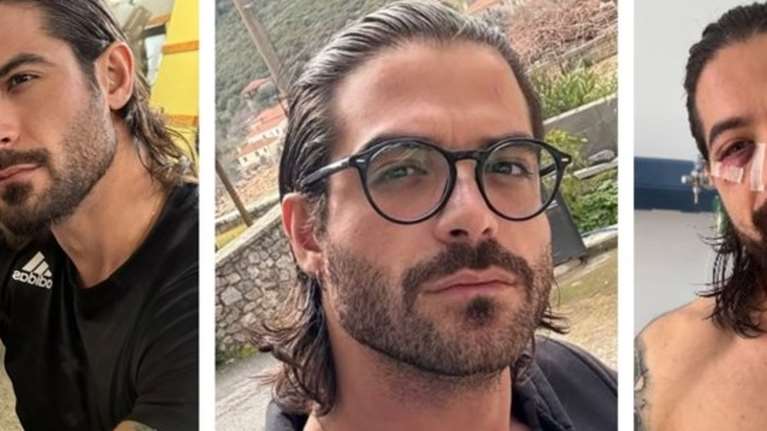 Παρουσιάστηκε στην αστυνομία ο άνδρας που έδωσε την κροτίδα στον Άρη Μουγκοπέτρο - &quot;Τη βρήκα κάτω, δεν ήξερα τι είναι&quot;