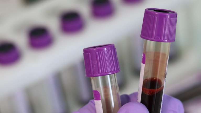 Ελπίδες για τη θεραπεία του καρκίνου: Συνδυασμός φαρμάκων μπορεί ακόμα και να εξαφανίζει όγκους από κεφάλι και λαιμό