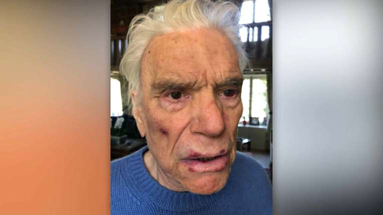 Γαλλία: Οι φωτογραφίες σοκ του επιχειρηματία Μπερνάρ Ταπί - Ληστές τον ξυλοκόπησαν μαζί με τη σύζυγό του