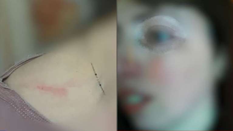 Συγκλονίζει η 29χρονη Αριάνα: "Με χτυπούσε συνέχεια - Φοβάμαι ότι θα είμαι το επόμενο θύμα γυναικοκτονίας" [Βίντεο]