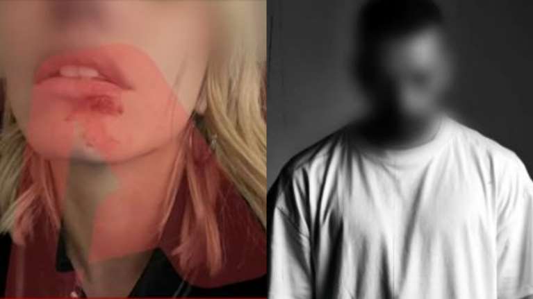 Ξυλοδαρμός μοντέλου από Dj: &quot;Θα σας σκοτώσω με τα ίδια μου τα χέρια&quot; - Οι απειλές του 40χρονου στην πρώην σύντροφό του