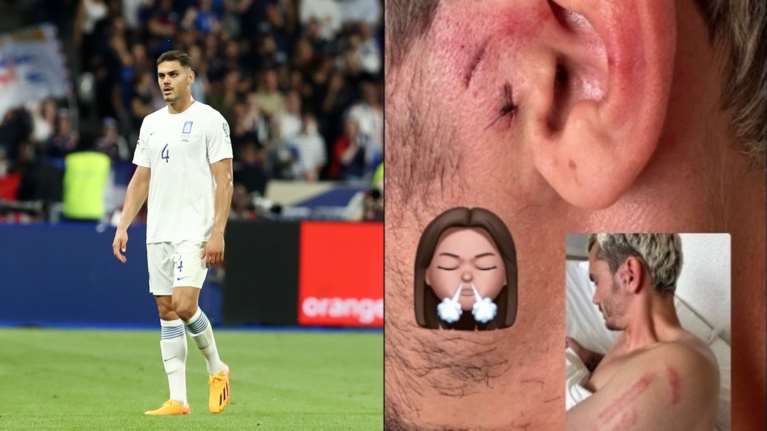 Έξαλλη η σύζυγος του Γάλλου Αντουάν Γκριεζμάν για τις πληγές από το χτύπημα του Μαυροπάνου [Εικόνα]