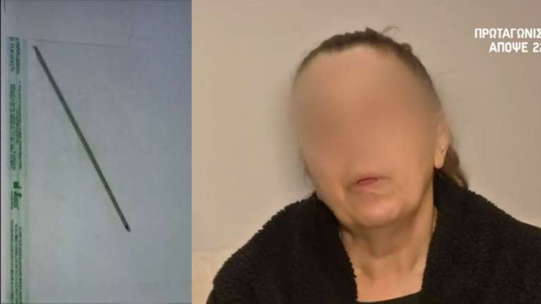 Θεσσαλονίκη: &quot;Ζω από θαύμα&quot; - Τι λέει η 59χρονη για τη βελόνα 13 εκατοστών που ξέχασαν οι γιατροί μέσα της [Βίντεο]