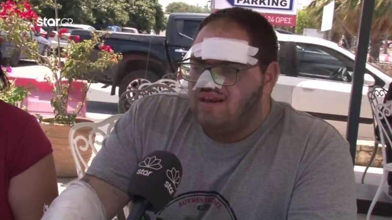 Κρήτη: Το ξενοδοχείο θα καλύψει τα έξοδα θεραπείας του μάγειρα που κάηκε με λάδι - &quot;Βρέθηκε λύση&quot; λέει ο Άδωνις