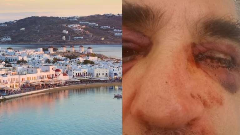 Μύκονος: Στα ίχνη των δραστών της μαφιόζικης επίθεσης στον αρχαιολόγο βρίσκεται η Αστυνομία [Βίντεο]